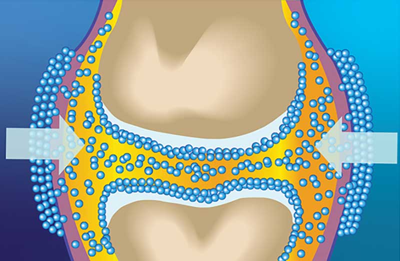 NANOFLEX Joint Support - Inside the Joint